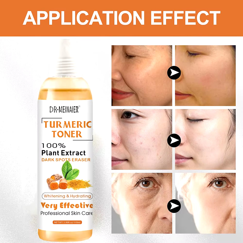 2Pcs Tumeric Dark Spots Toner Spots Eraser Corrector Turmeric Fade Blemishes Dark Spot Remover Acne Remover Toner for Dark Skin