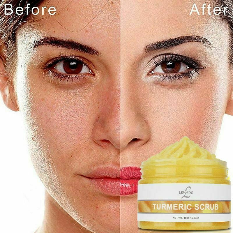 Tumeric Body Scrub, Acne, Dark Spots, Hyperpigmentat