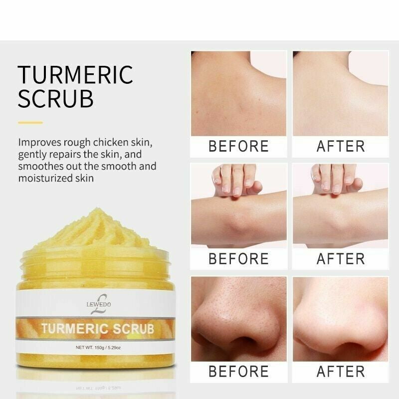 Tumeric Body Scrub, Acne, Dark Spots, Hyperpigmentat